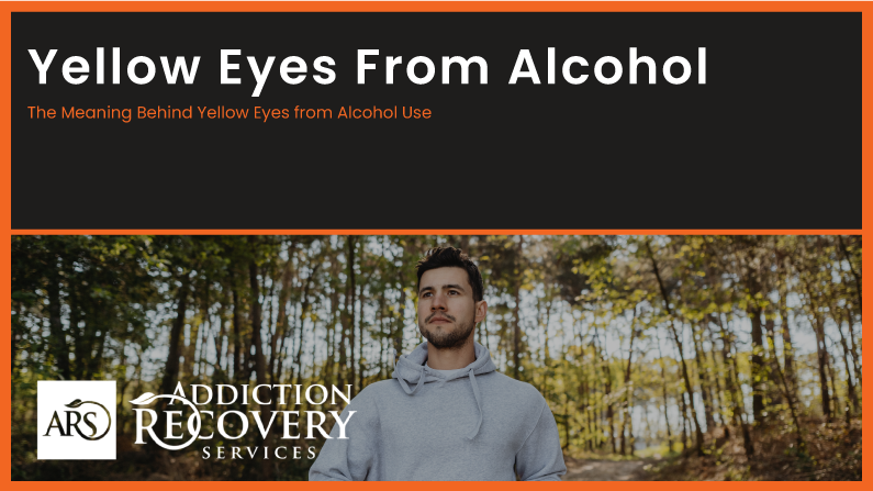 Yellow Eyes From Alcohol